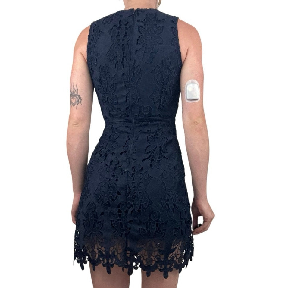 H&M Navy Blue Lace Mini Dress